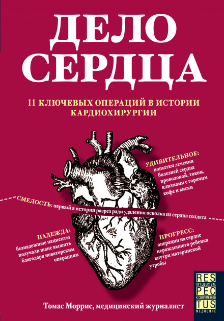 Справа серця. 11 ключових операцій в історії кардіохірургії